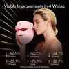 image:imageINIA GLOW 4D Wireless Red Light Therapy Mask for Face Dual NIR 320 LEDsPink