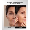 image:imageINIA GLOW Wireless Red Light Therapy Mask for Face 850nm NIR 272 LEDsPink
