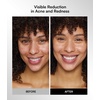 image:imageINIA GLOW Wireless Red Light Therapy Mask for Face 850nm NIR 272 LEDsPink
