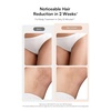 image:imageINIA HAUTE Pro Laser Hair Removal with IceCooling Care for Women and MenPink