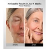image:imageINIA Red Light Therapy Mask for Face 850nm NIR RedBlue LED Light 4 ModesPink